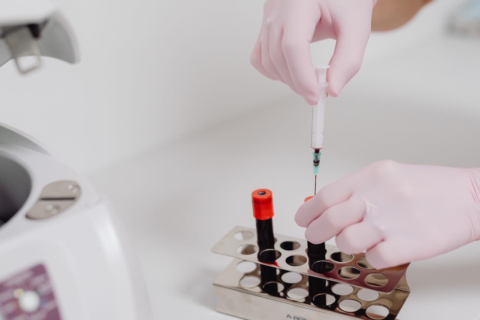 Laboratory hands processing blood sample tubes